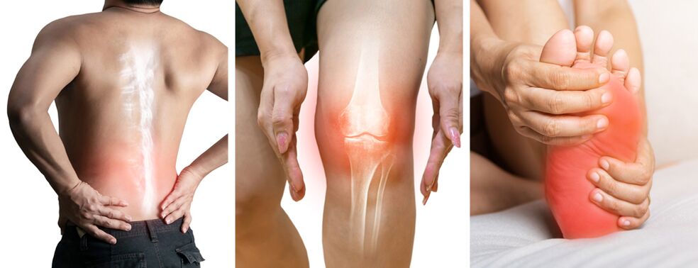 Treatment of Hondrolife joint pain